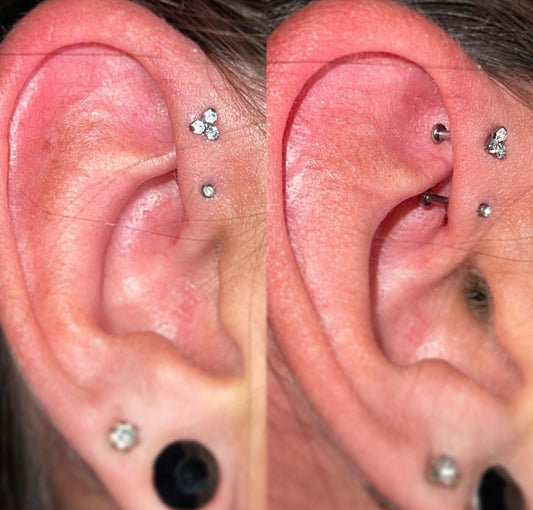 Forward Helix