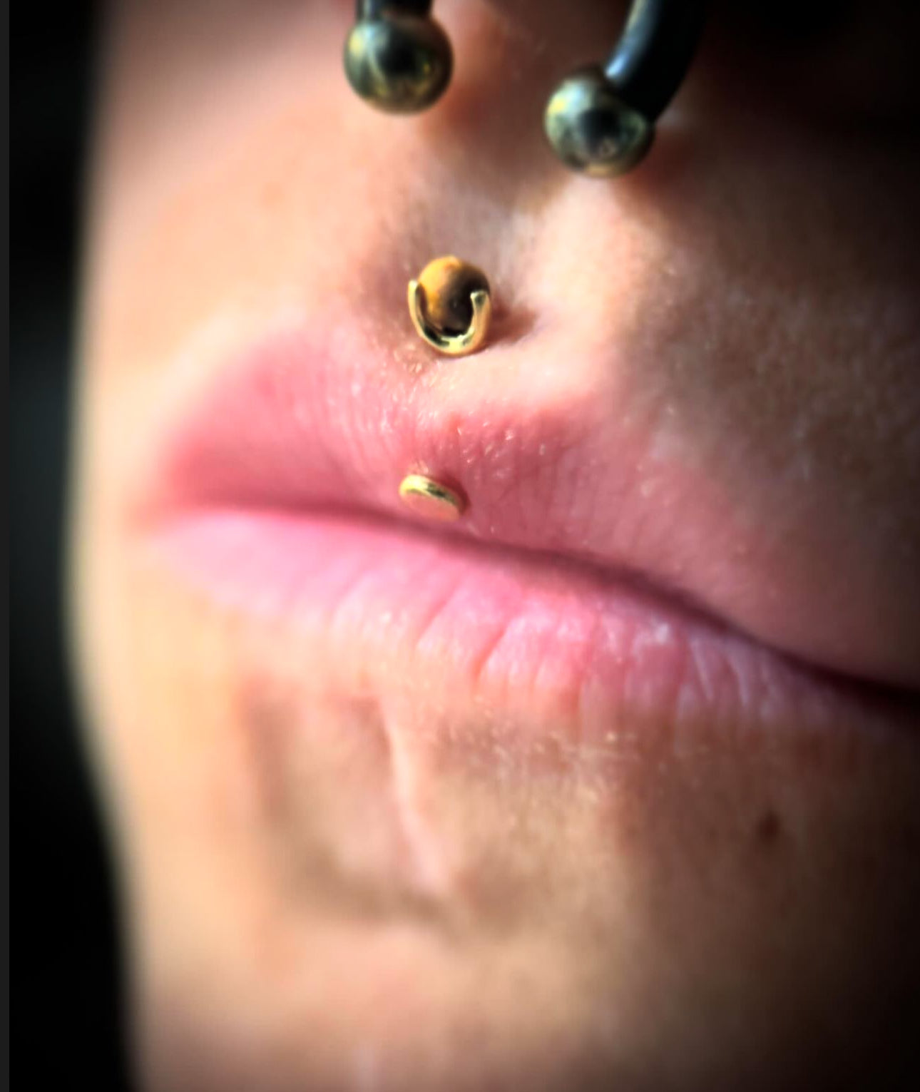 Vertical Philtrum (Jestrum) Piercing