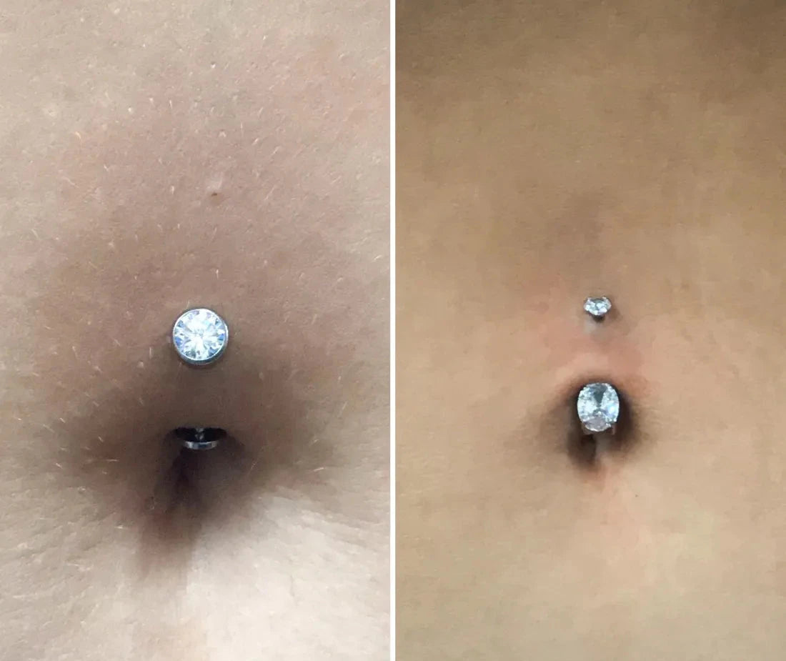 Navel (Belly Button) Piercing